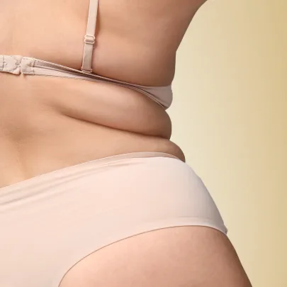 Cennik zabiegów według problemu w Kashmir Spa - redukcja tkanki tłuszczowej - zdjęcie pokazuje boczki kobiety z nadmiarem tkanki tłuszczowej