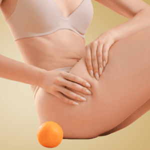 Cennik zabiegów według problemu w Kashmir Spa przedstawia zdjęcia ilustrujące efekty zabiegu antycellulitowego, kobieta w bieliźnie dotyka swojego uda obok pomarańczy, symbolizującej cellulit. Przewodnik.