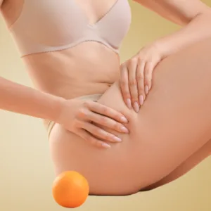 Cennik zabiegów według problemu w Kashmir Spa przedstawia zdjęcia ilustrujące efekty zabiegu antycellulitowego, kobieta w bieliźnie dotyka swojego uda obok pomarańczy, symbolizującej cellulit. Przewodnik.