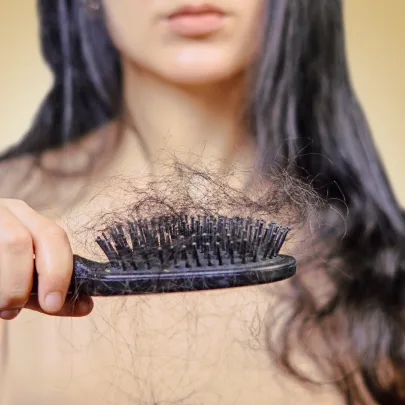 TRYCHOLOGIA - ZDJĘCIE PRZEDSTAWIA KOBIETĘ ZE SZCZOTKĄ W DŁONI Z DUŻĄ ILOŚCIĄ WŁOSÓW. JAKO ROZWIĄZANIE KASHMOR SPA POLECA ZABIEG: MEZOTERAPIA SKÓRY GŁOWY DR CYJ