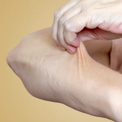 Cennik zabiegów według problemu w Kashmir Spa - wiotka skóra - zdjęcie przedstawia dłoń ciągnącą za skórę na przedramieniu pokazując jej wiotkość