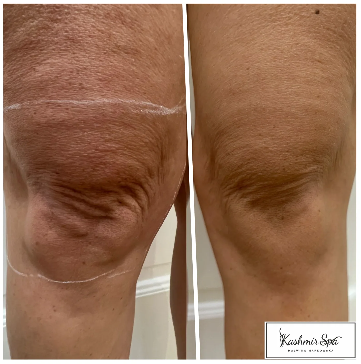 Purple Modern beauty Spa Poster (12)