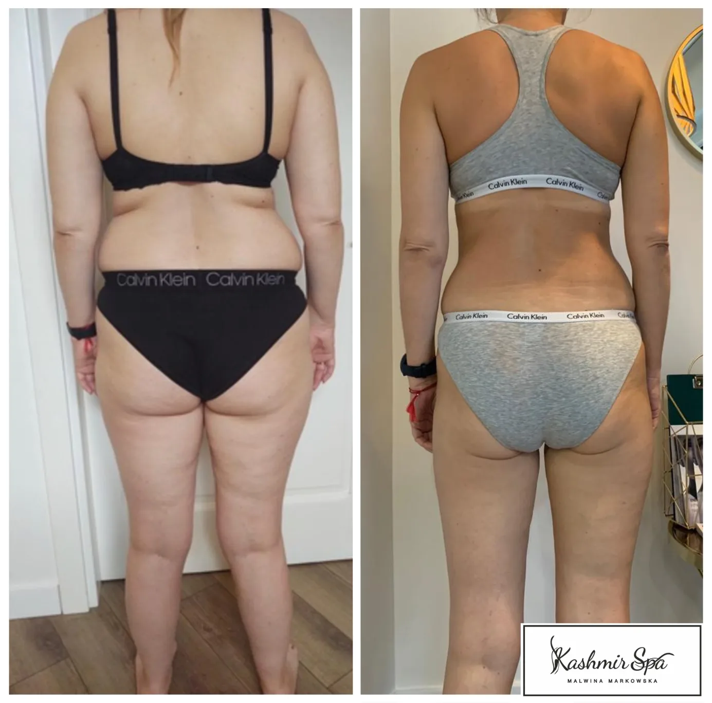 Purple Modern beauty Spa Poster (13)