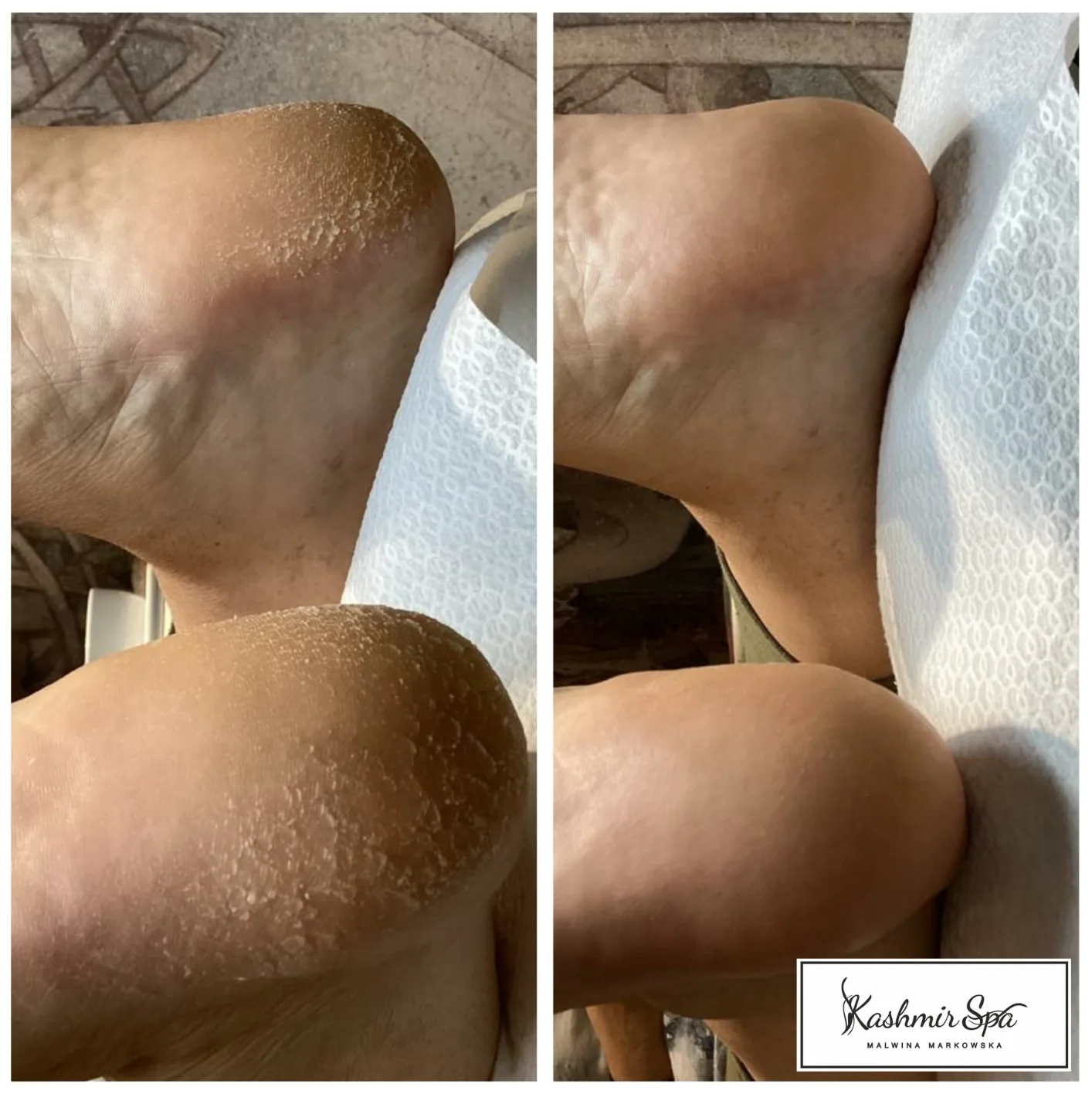 Purple Modern beauty Spa Poster (15)