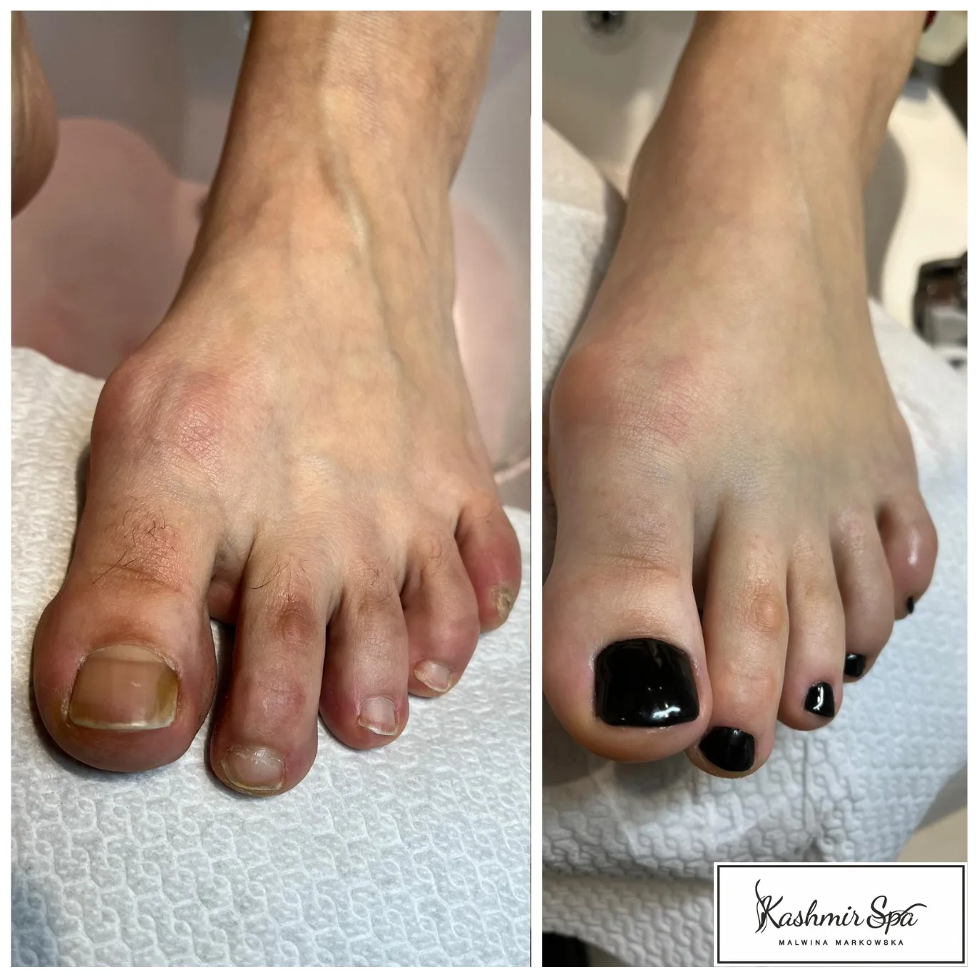 Purple Modern beauty Spa Poster (16)