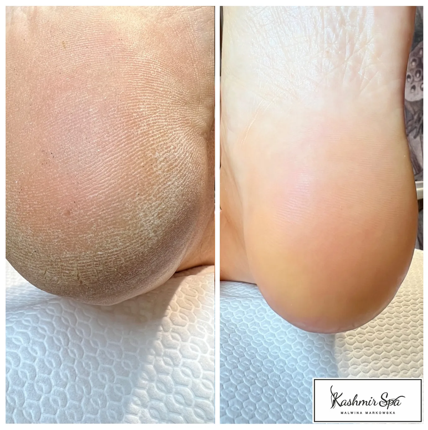 Purple Modern beauty Spa Poster (17)