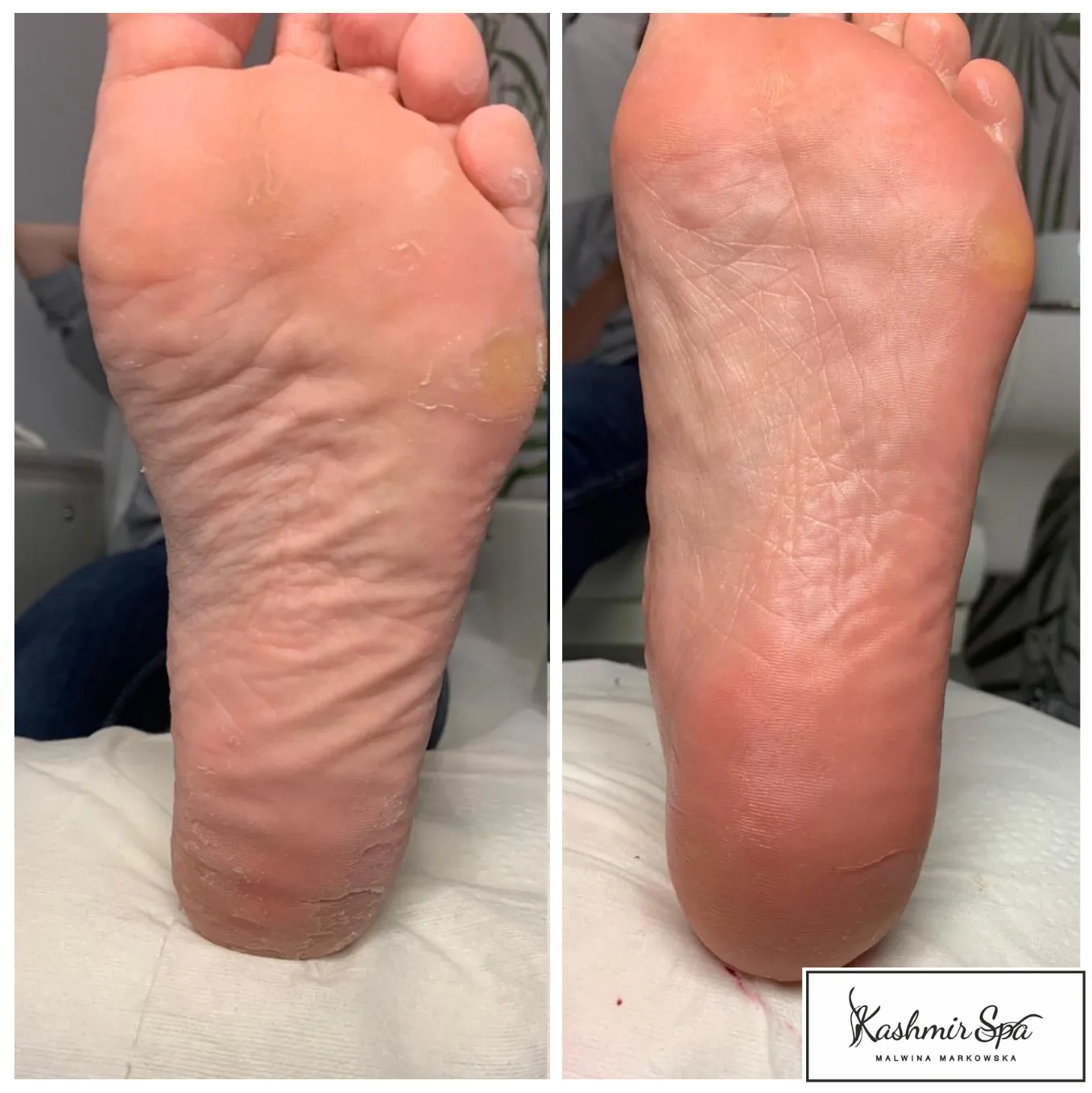 Purple Modern beauty Spa Poster (18)