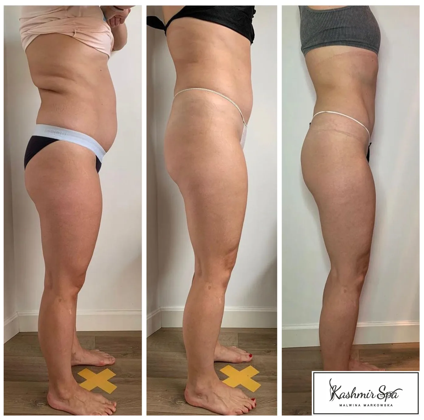 Purple Modern beauty Spa Poster (8)