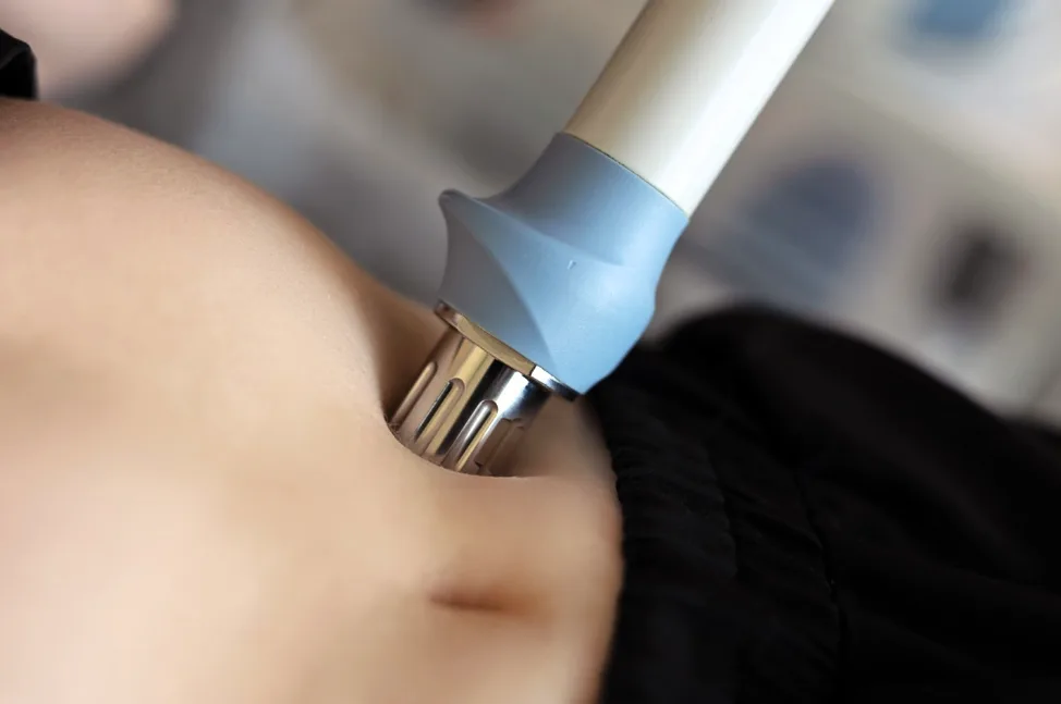 Fala uderzeniowa BTL na brzuchu pacjentki w Kashmir Spa Malwina Markowska Gdańsk.