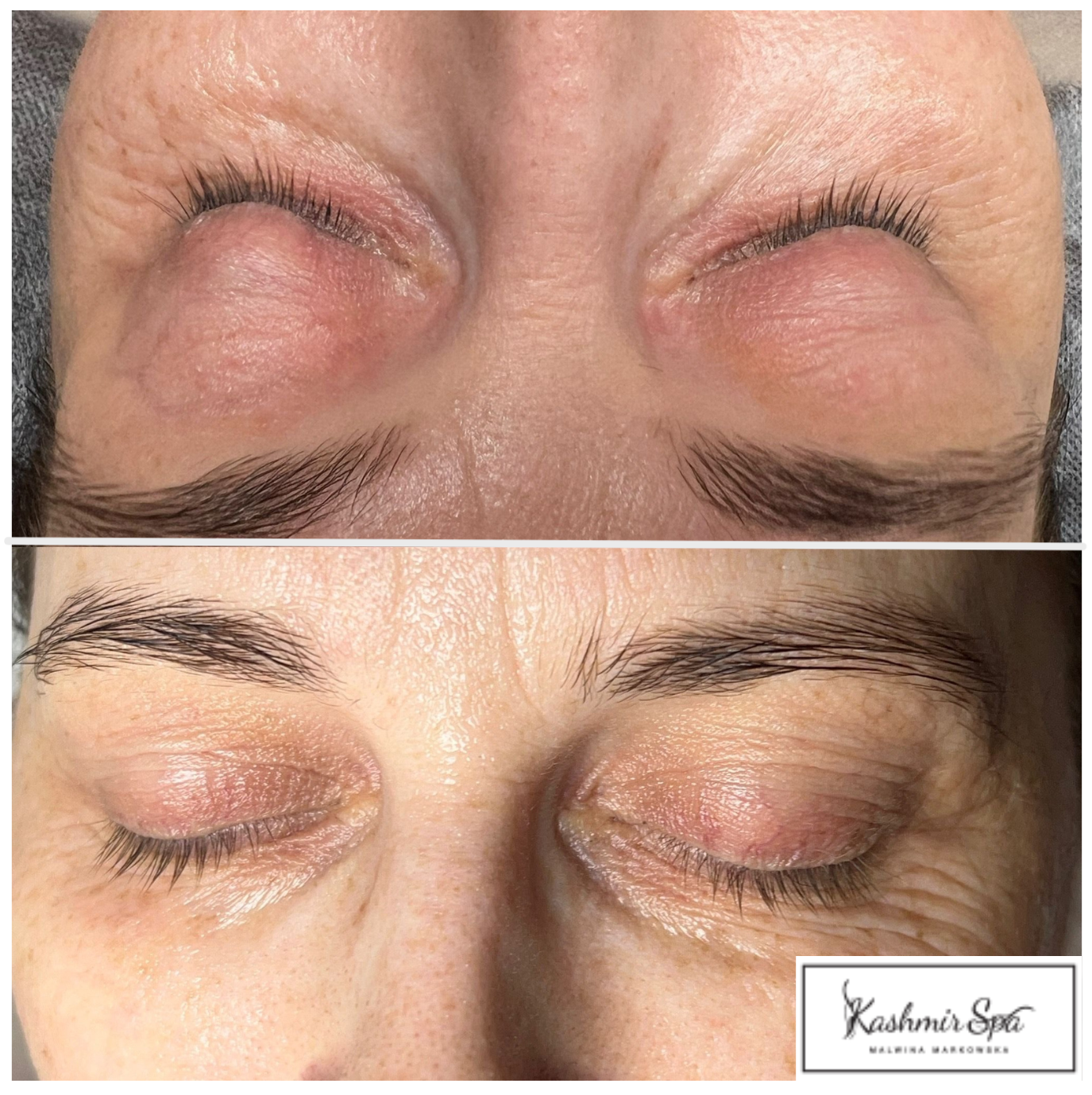 BIOSTYMULATORY TKANKOWE