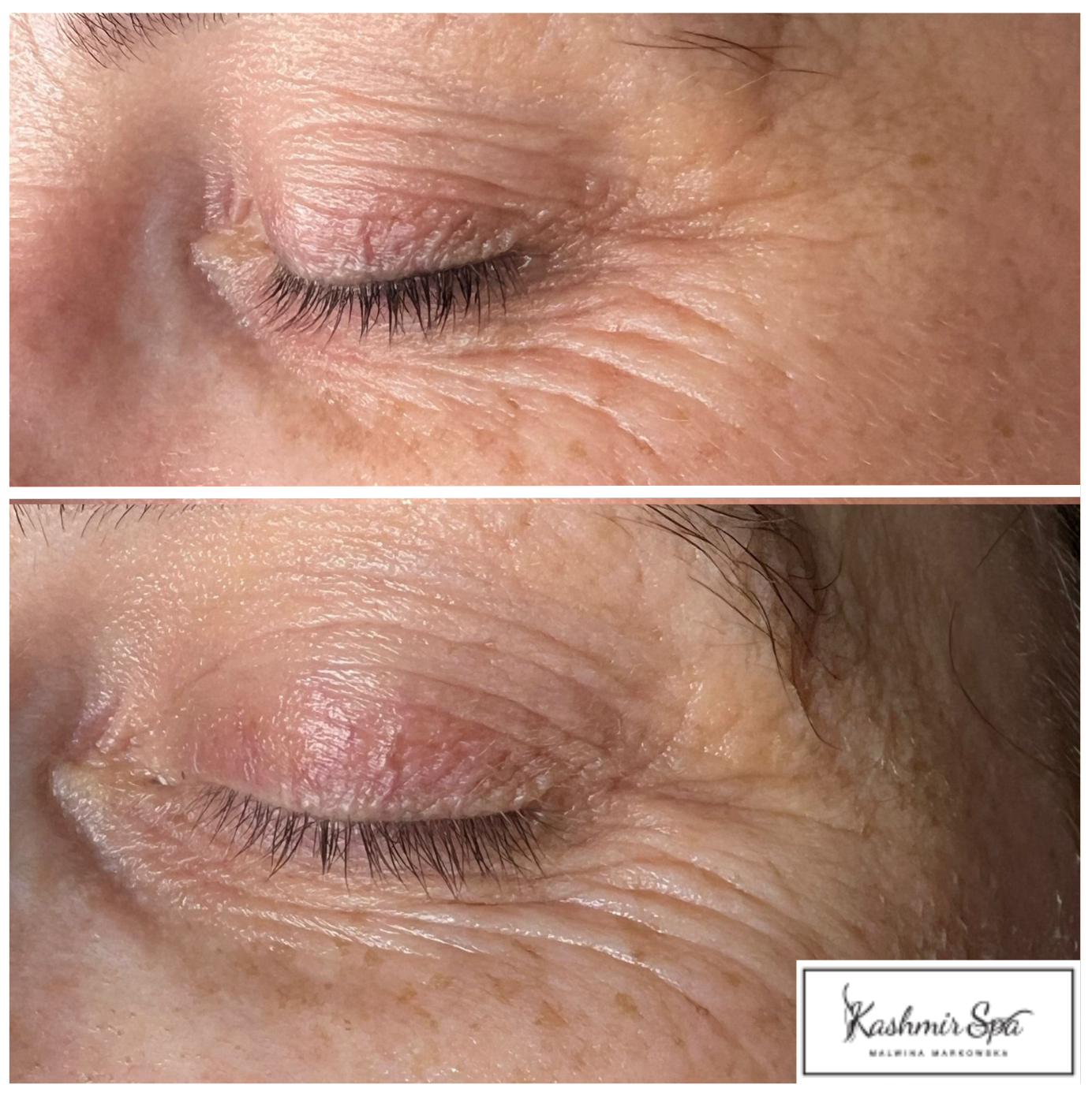 BIOSTYMULATORY TKANKOWE